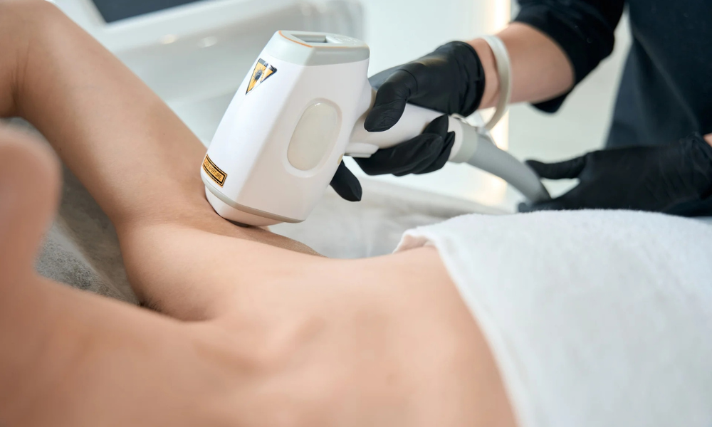 A close-up photo of a laser hair removal session, where a technician wearing black gloves uses a handheld laser device on a client's under arm