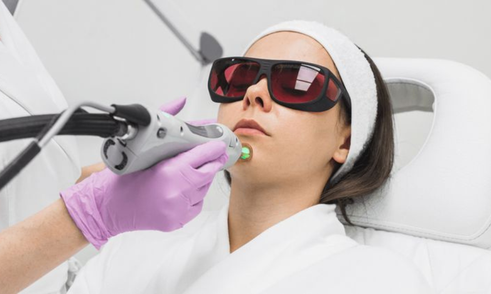 A woman wearing dark protective goggles and a white headband receiving a laser skin treatment on her chin by a technician wearing a purple medical glove.